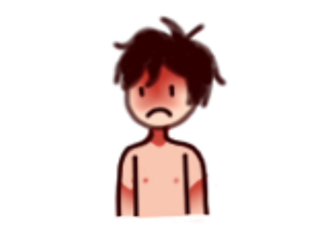 Sad Sunburnt Espana