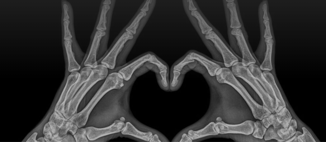 Love scars